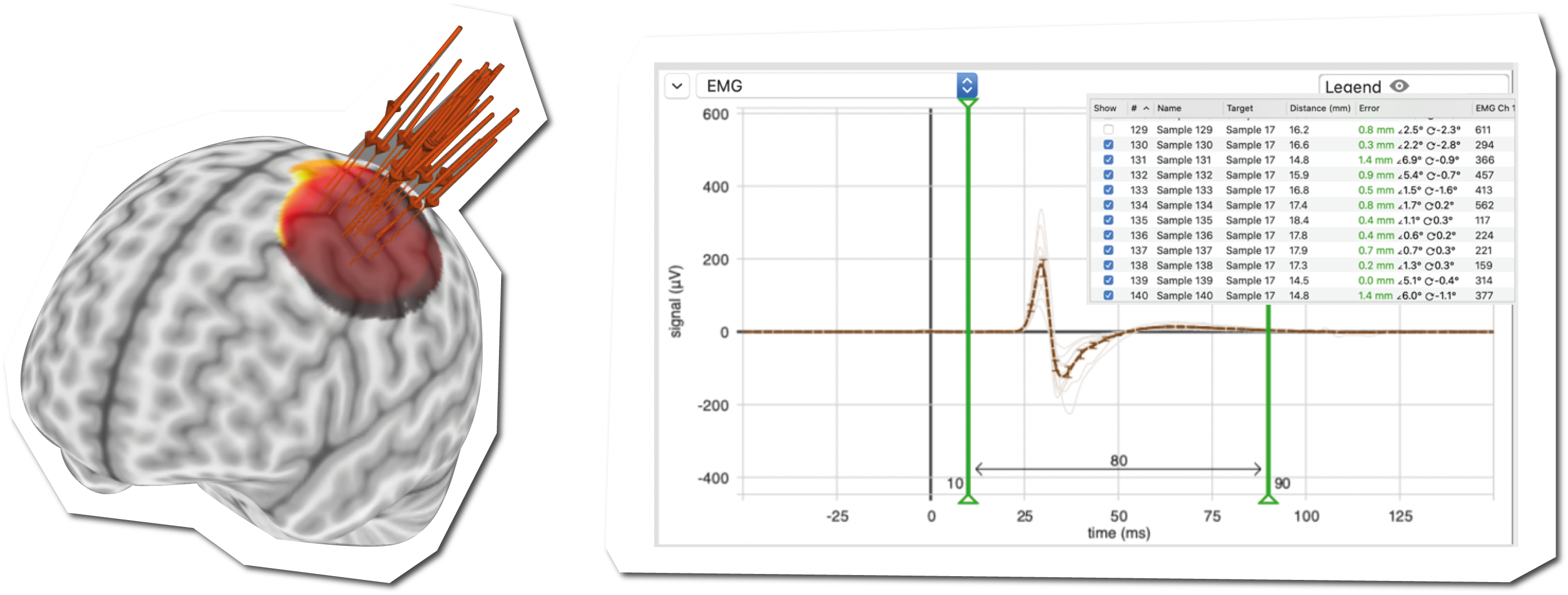 Brainsight TMS Navigation Brainbox